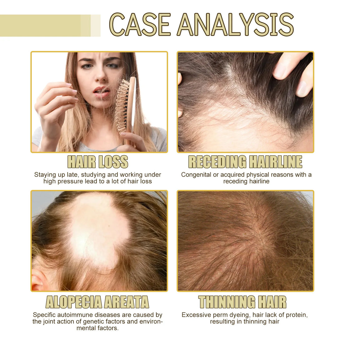 Rosemary Scalp Growth Oil