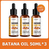 Batana Oil Hair Growth Treatment