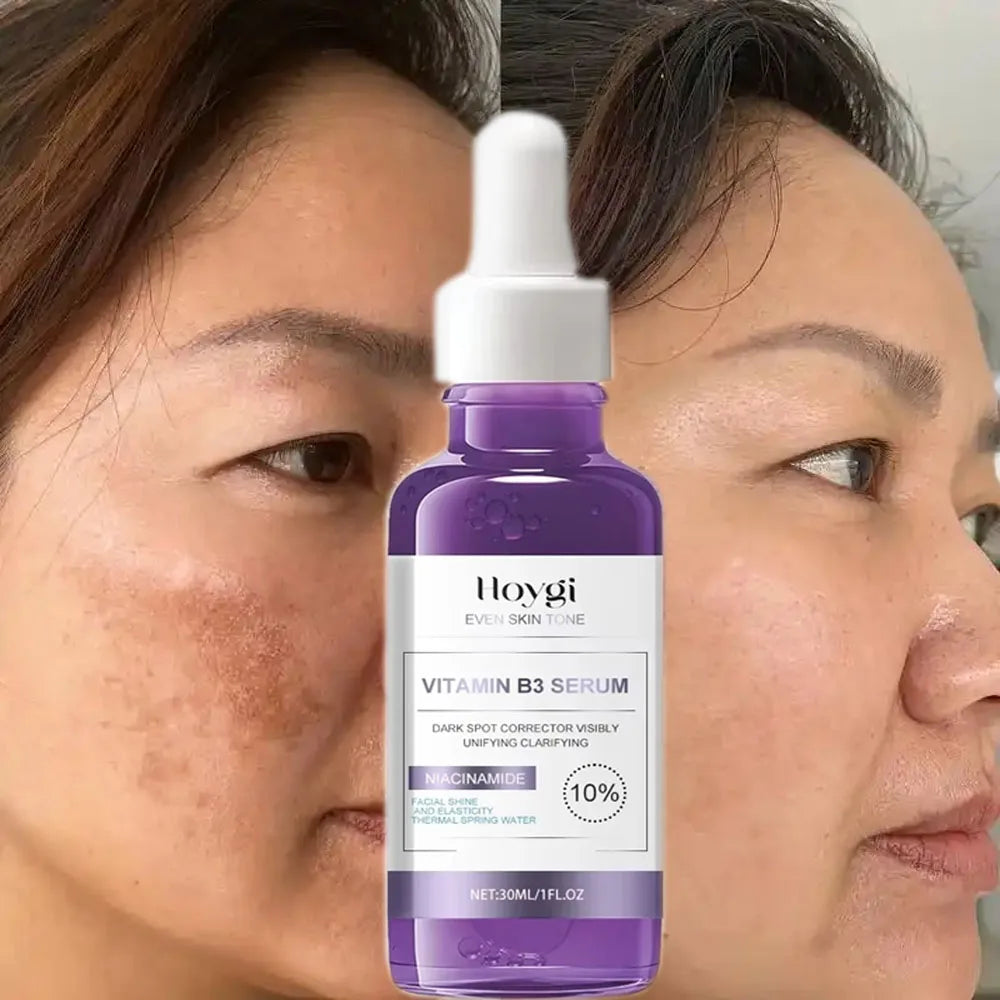Dark Spot Brightening Serum