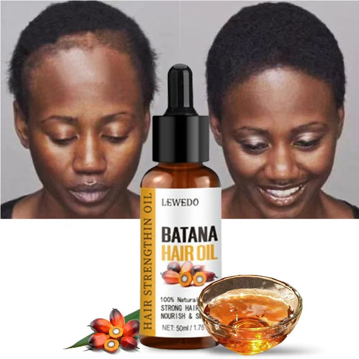 Batana Oil Hair Growth Treatment